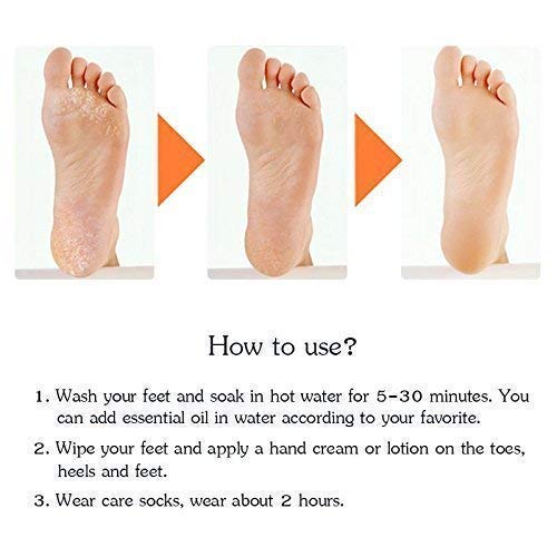 A One Mall® Anti Crack Full Length Silicone Foot Protector